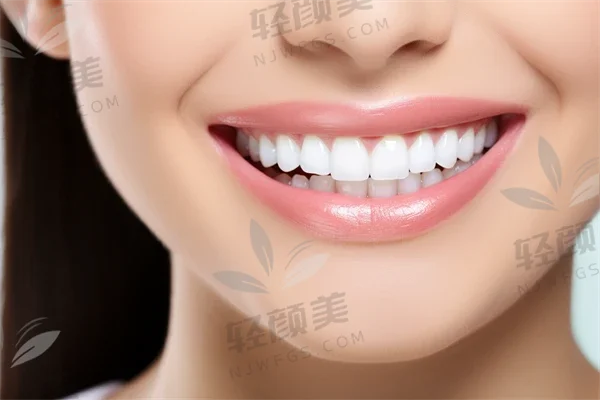 体验佛山正福口腔的牙齿美白服务，分享焕然一新的笑容感受与结果，助您重拾自信与魅力。