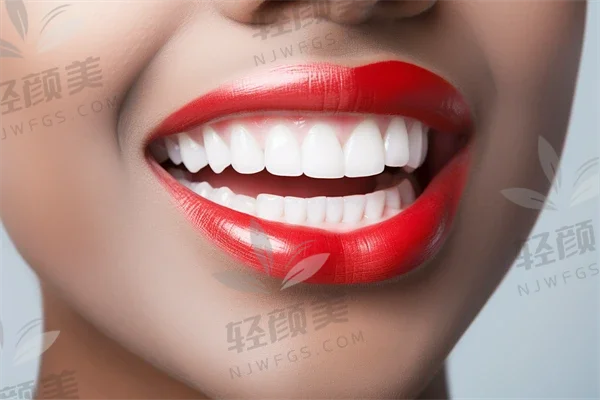 想了解巴西 Neodent 种植体怎么样？从品牌、特点到价格，一文为你深度剖析！