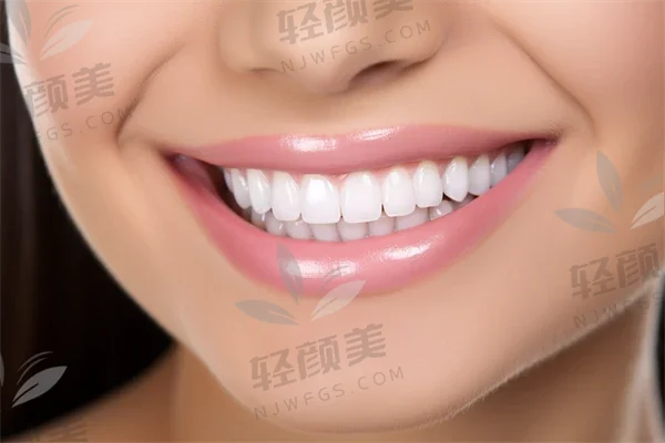 在聊城爱尔眼科做的近视手术，术后无干眼症而且看东西还清晰了