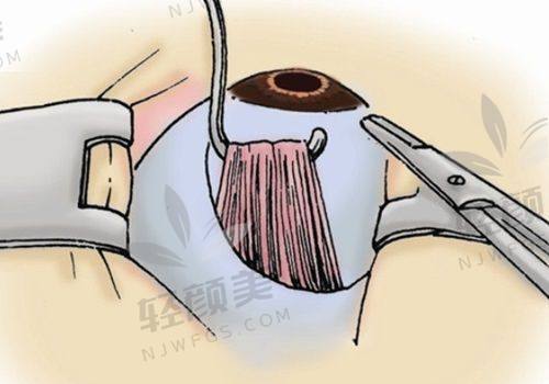 新疆生产建设兵团总医院眼科是正规的吗