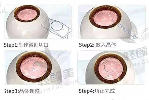 术后修复：关注后遗症情况
