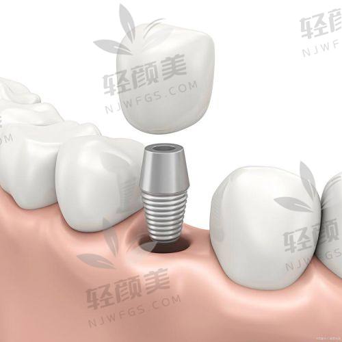 西安中诺口腔是正规靠谱的机构吗？听听阿姨咋说