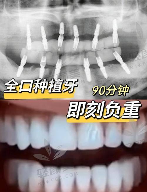 高龄老人能不能做种植牙？原来60岁才刚刚开始