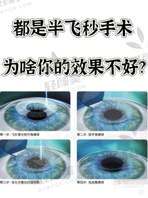 四、手术当天：有点紧张，但真的不到10分钟就搞定了！