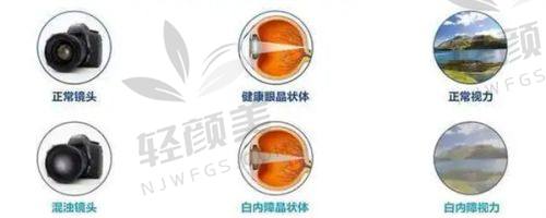 小编总结：人生的“视界”，值得投资一次