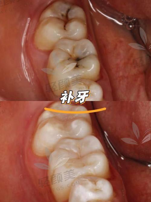 七、如何挑选靠谱医院补牙？四看法则了解一下