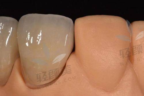?第一次戴上那叫一个惊艳！
