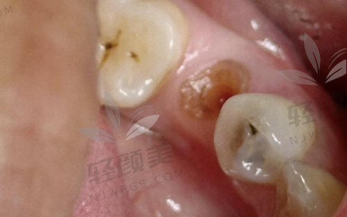 固原舒康口腔医院（彭阳店）擅长什么项目