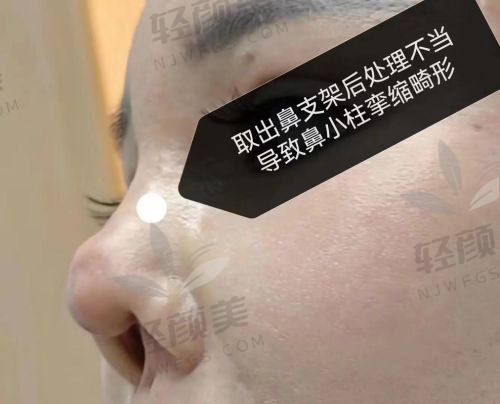 吴忠市谢俪医疗美容诊所是正规的吗？