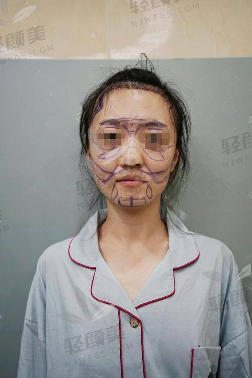 2026 手臂皮肤松弛切除手术价格表出炉，掌握这些要点轻松应对手术费用