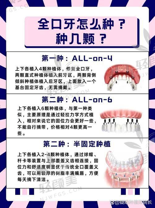 一、北京中诺口腔立得用种植牙是啥？听说术后当天能啃苹果？