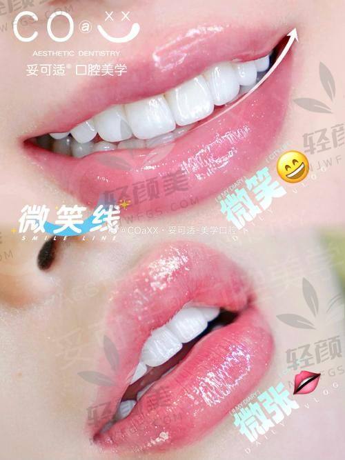 2026 牙齿美白价格表大揭秘！国内各城市口腔机构美白费用全知晓