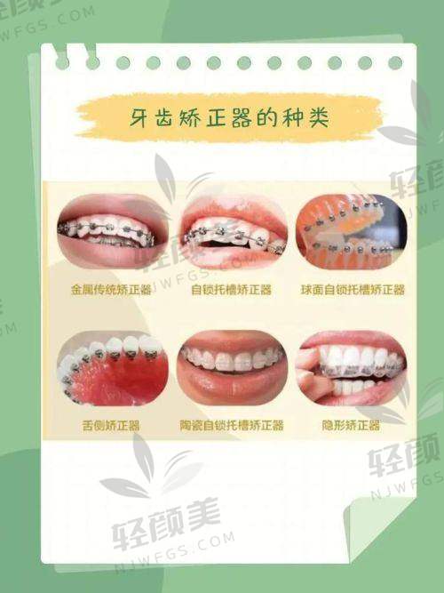 06 小编总结：整牙值不值得？看完这几点你就知道了！