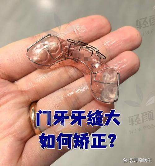 02 整牙会不会后悔系列，我来一个个真实回答