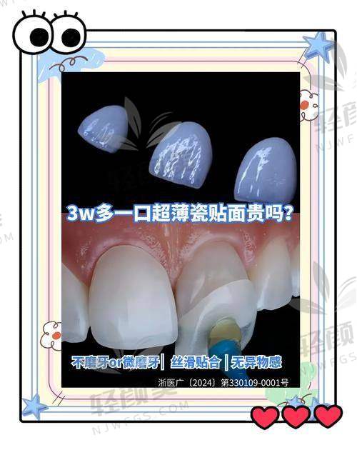 三、各大城市热门医院牙齿贴面价格曝光，别被表面“亲民”诱惑