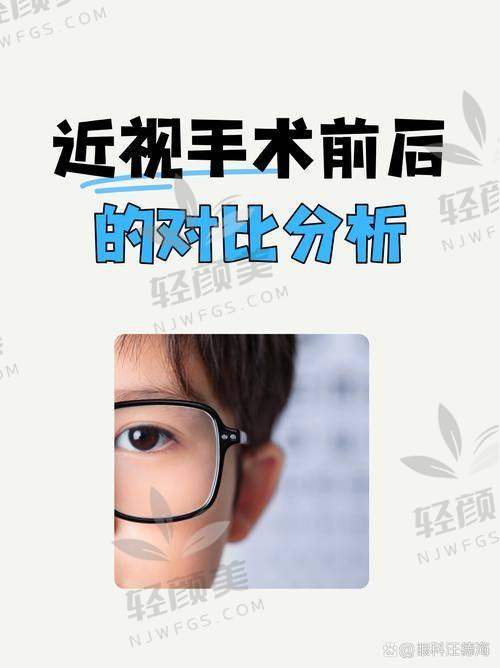 各自是什么原理？不懂激光能量的，咱举个栗子！