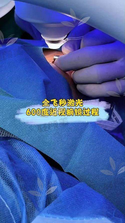 一、为什么我选择做全飞秒手术？