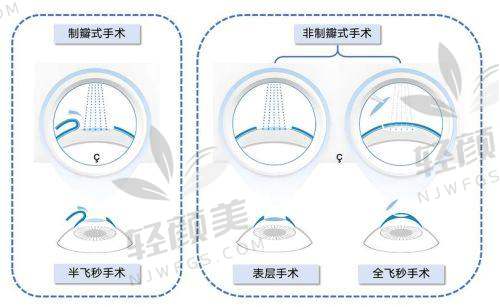 四、术后那点事：生活便利+回访机制+复查体验