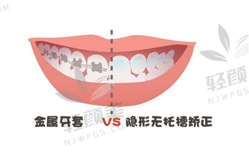 五、什么样的孩子适合哪种装置？别选错啦！