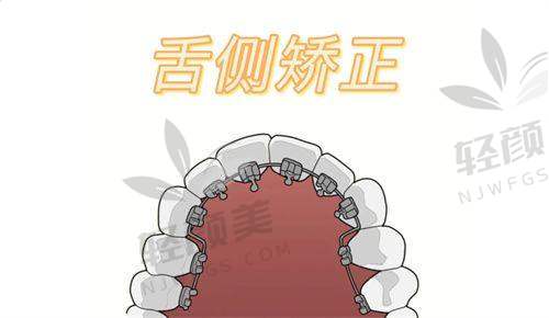 ✔ 头帽肌激动器原理