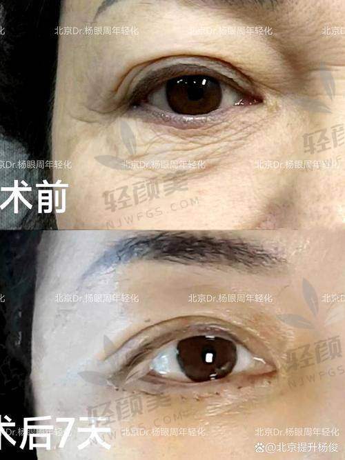 张笃林医生怎么预约挂号？