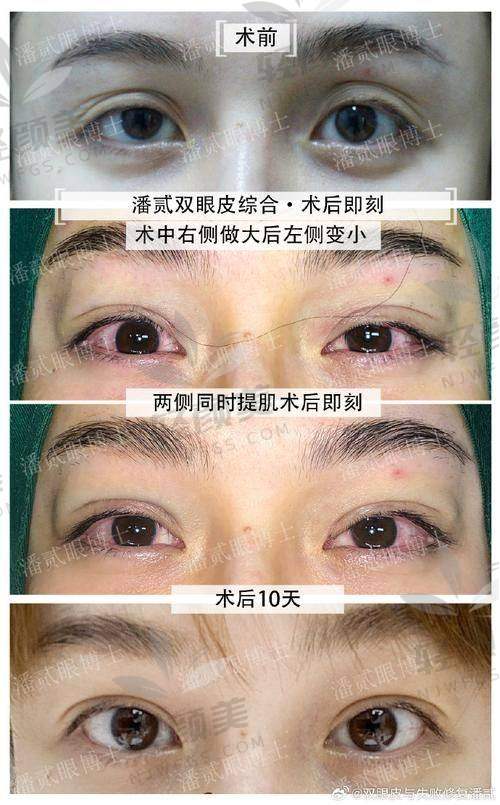 张笃林医生技术到底怎么样？