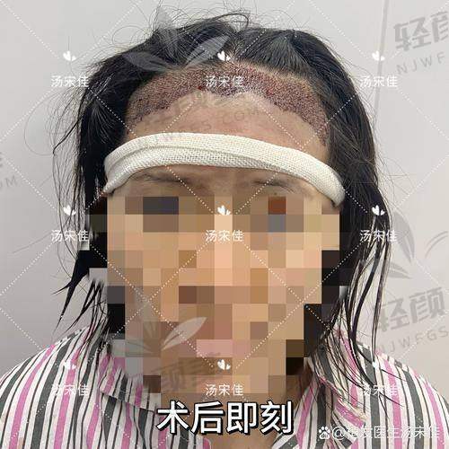 04｜来来来，500单位VS1000单位VS2000单位面积对比表看这