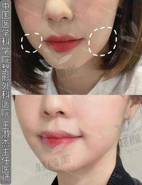 李纪先医生技术特点