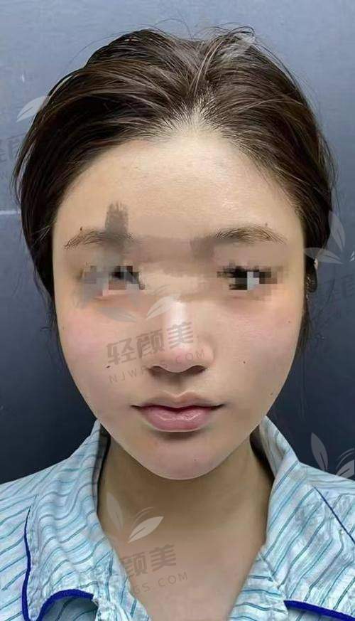 李纪先医生怎么预约挂号？