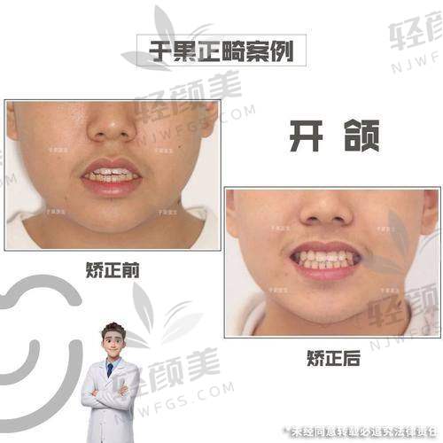 三、原理不同，就决定了它们适合的孩子也大不同！