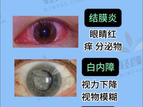 宁夏朝聚开明眼科医院是私立还是公办医院？
