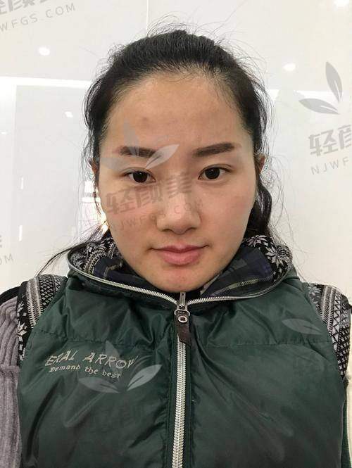 李纪先医生擅长项目