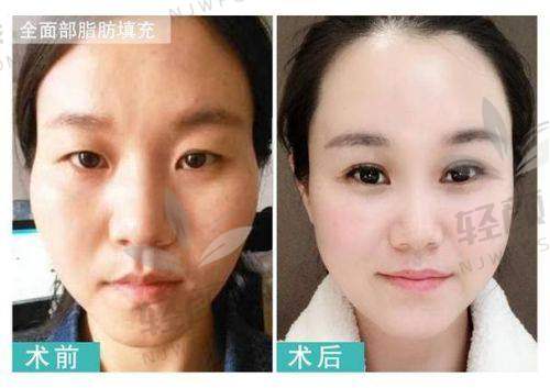 李纪先医生简介