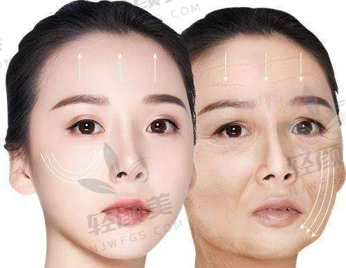 八、小编总结：别等了，这波面子级提升绝对值