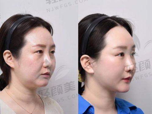 银川丽都医疗美容医院是私立还是公办