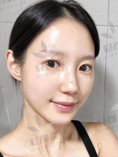 三、面诊袁强博士，全程真实体验记录
