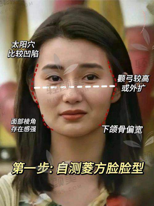 一、先来搞明白：颧骨高 VS 颧骨外扩，到底啥区别？