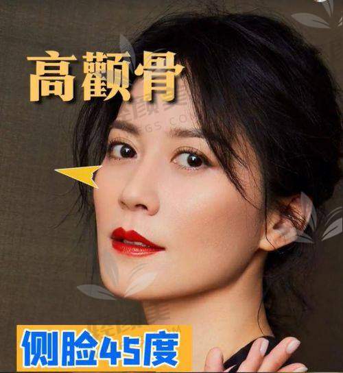 五、到底做不做颧骨调整？看这3个关键因素