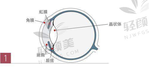 说美好也得说实话：ICL晶体植入的“隐性成本”