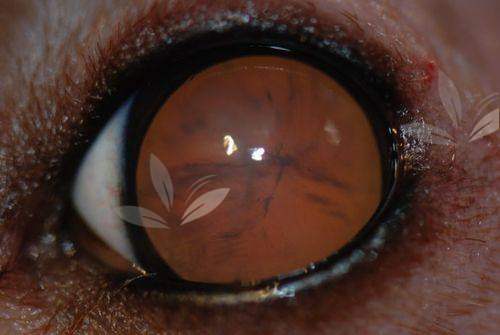 哈尔滨眼科韩清做白内障好吗？技术没得说因为我亲身经历过