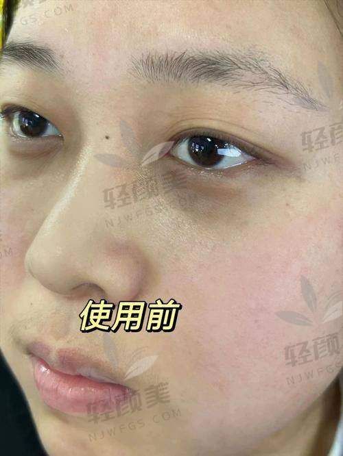 王丽媛医生技术特点