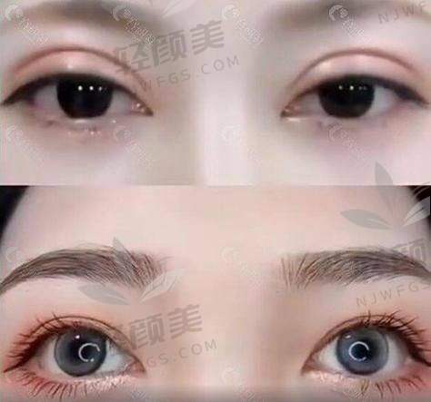 八、亲测推荐：术后我变得有多社牛