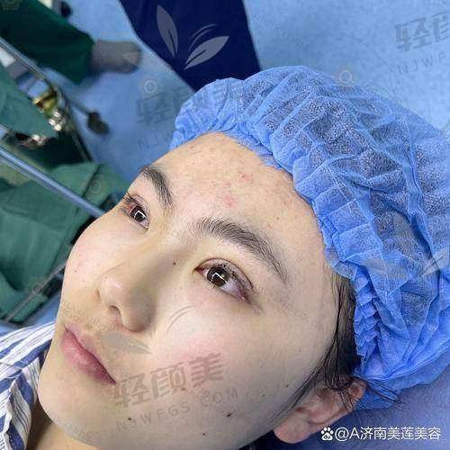 五、避坑须知：双眼皮不等于“妈生款”，术前必问这三点！