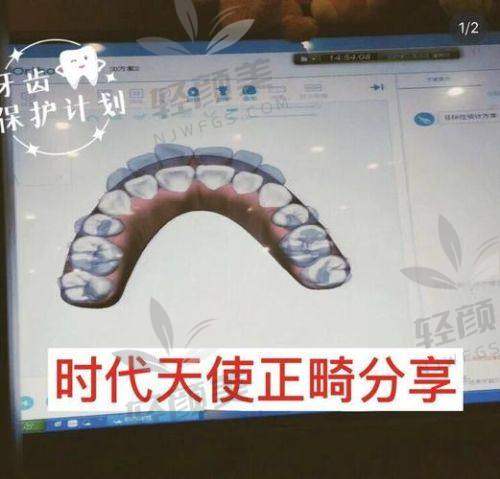 六、总结：矫正不是有钱任性，是得会算账！