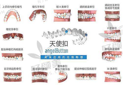 四、价格套路完全解密：你怕的是贵，我怕的是“被套路”！