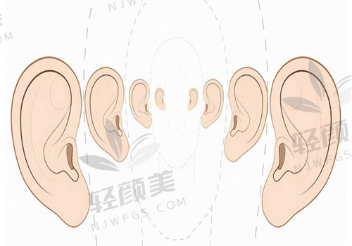 2025 全包法耳再造手术价格表大揭秘！各术式、地区费用全知晓