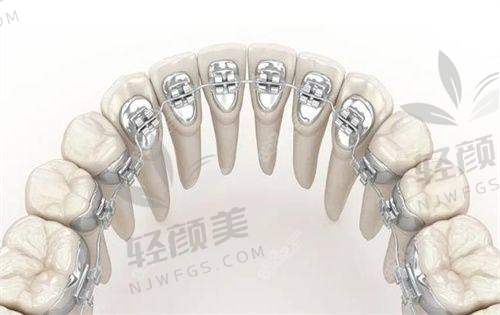 八、总结！到底怎么选？看你是哪种人 ?