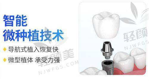 二、德韩口腔镶牙项目详解：不同材料适合不同人群