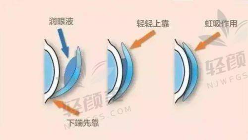 六、实用贴：在北京同仁眼科如何“花得值”？医生推荐+性价比匹配