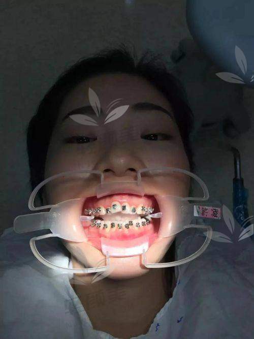五、价格解析！别被促销价迷惑，到底哪个更“值”？?